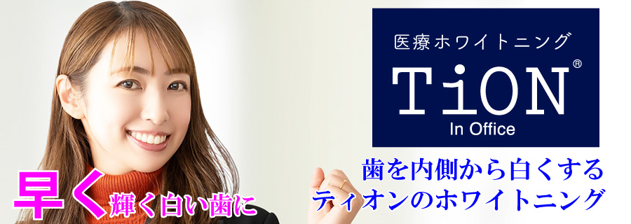ティオンのホワイトニング