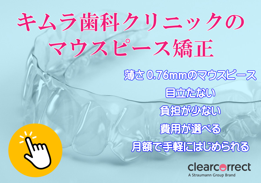 マウスピース矯正