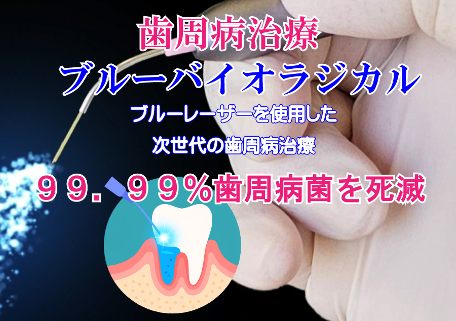 ブルーレーザーを使用した歯周病治療