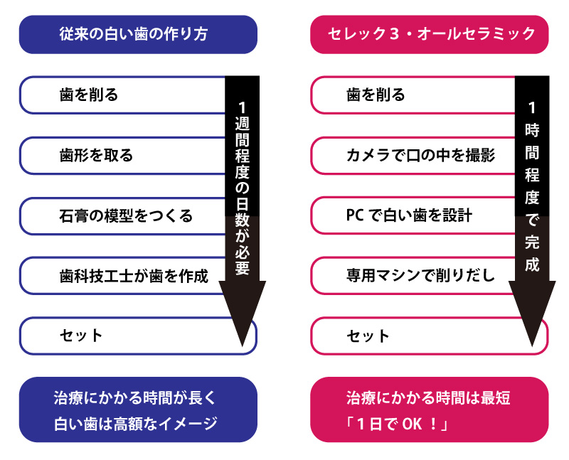オール寺ミックと従来の白い歯の工程と時間