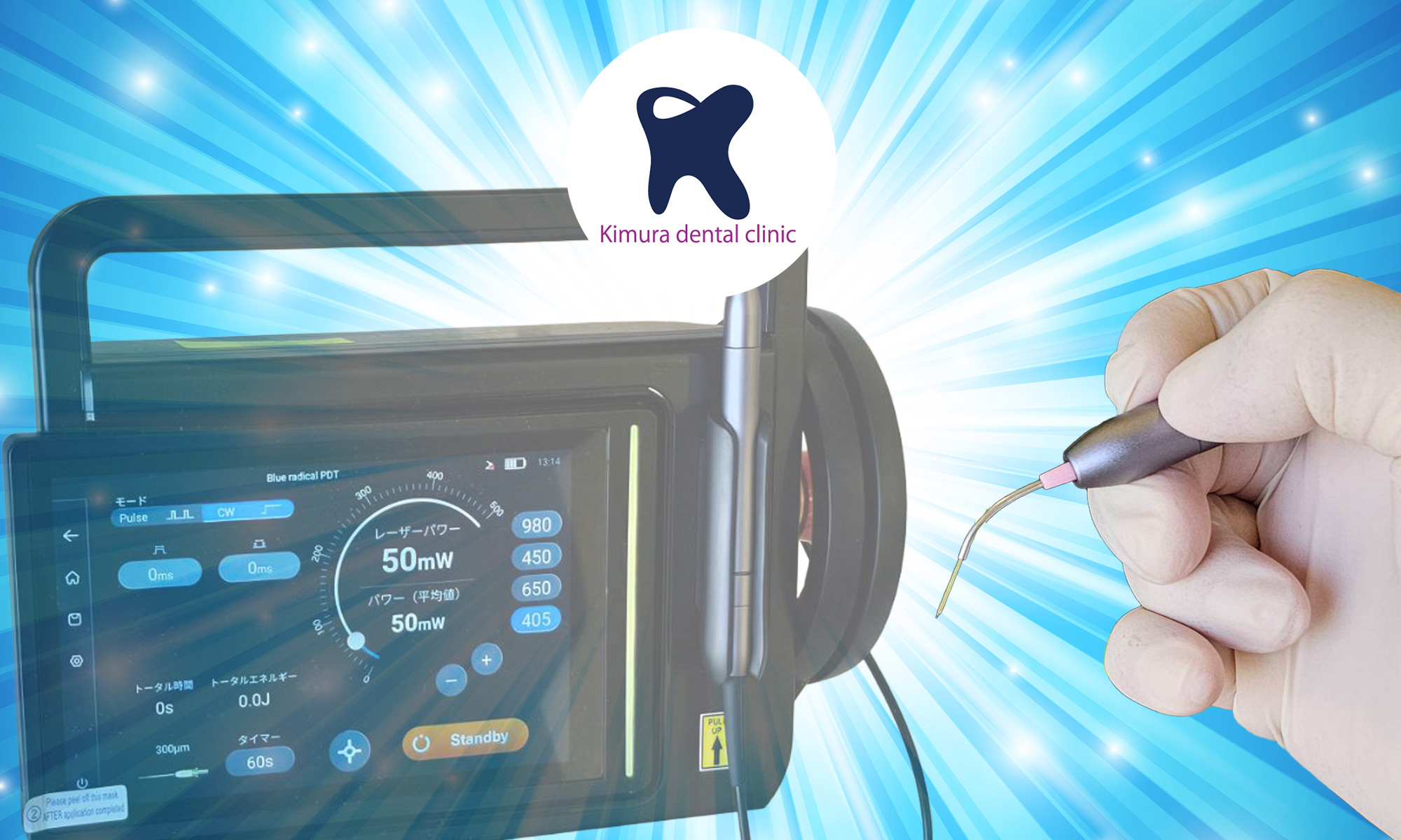 ブルーバイオラジカルのブルーレーザーを使用した歯周病治療