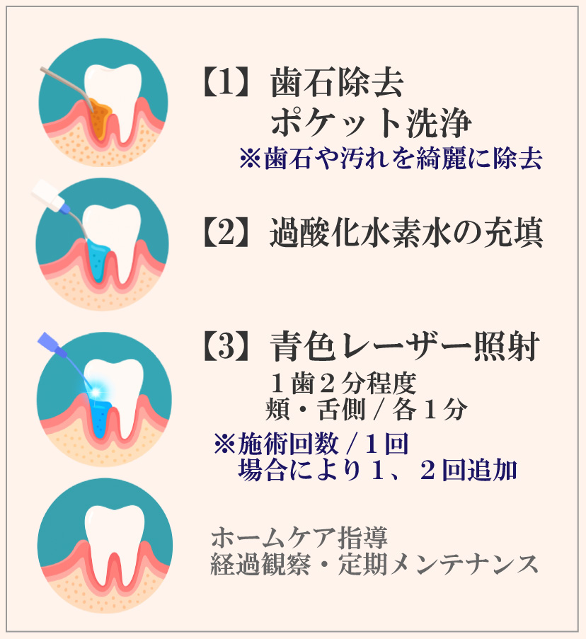 ブルーバイオラジカル治療方法